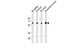 All lanes : Anti-Lyn Antibody (Center) at 1:2000 dilution Lane 1: mouse kidney lysates Lane 2: mouse heart lysates Lane 3: mouse ovary lysates Lane 4: mouse skeletal muscle lysates Lysates/proteins at 20 μg per lane. (LYN anticorps  (AA 229-263))