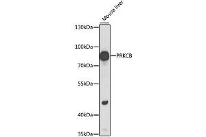 Western blot analysis of extracts of mouse liver, using PRKCB antibody (ABIN6290747) at 1:1000 dilution. (PKC beta anticorps)