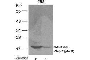 Image no. 2 for anti-Myosin, Light Chain 2, Regulatory, Cardiac, Slow (MYL2) (pSer18) antibody (ABIN319223) (MYL2 anticorps  (pSer18))