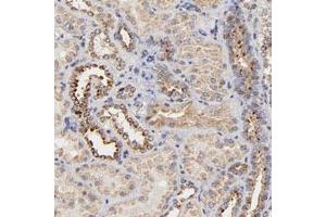 Immunohistochemical staining of human kidney with FMNL3 polyclonal antibody  shows moderate granular cytoplasmic positivity in cells of tubules at 1:200-1:500 dilution.