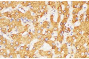 Immunohistochemistry of paraffin-embedded Human liver using FGB Polycloanl Antibody at dilution of 1:200