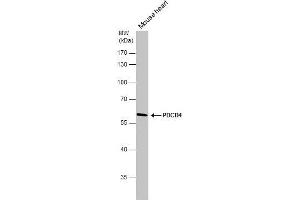 WB Image PDCD4 antibody detects PDCD4 protein by western blot analysis. (PDCD4 anticorps)