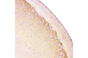 IHC-P testing of rat brain tissue. (APP anticorps  (C-Term))