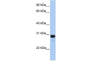 WB Suggested Anti-AMN1 Antibody Titration: 0.