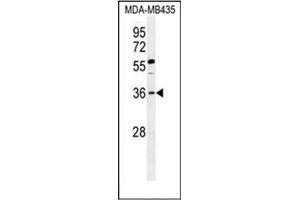 Western blot analysis of FOXE3 / FKHL12 Antibody (Center) in MDA-MB435 cell line lysates (35ug/lane). (FOXE3 anticorps  (Middle Region))