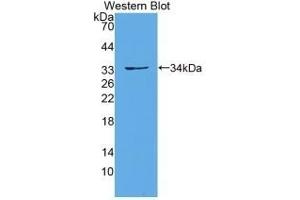 Detection of recombinant PCDH15 using Polyclonal Antibody to Protocadherin 15 (PCDH15) (PCDH15 anticorps)