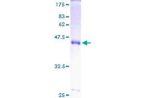 Superoxide Dismutase 1, Soluble (SOD1) (AA 1-154) protein (GST tag)