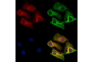 ABIN6265899 and ABIN6273182 staining Hela cells by IF/ICC. (UQCRC1 anticorps  (C-Term))