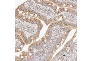Immunohistochemical staining of human duodenum with FAM20B polyclonal antibody  shows granular cytoplasmic positivity in glandular cells. (FAM20B anticorps)