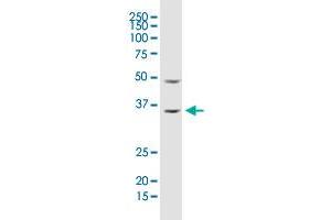 ARHGDIA monoclonal antibody (M02), clone 1G5-2F3. (ARHGDIA anticorps  (AA 1-204))