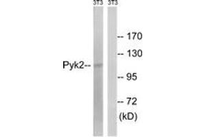 Western blot analysis of extracts from NIH-3T3 cells, using PYK2 (Ab-579) Antibody. (PTK2B anticorps  (AA 545-594))