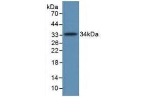Detection of Recombinant C5a, Human using Monoclonal Antibody to Complement Component 5a (C5a)