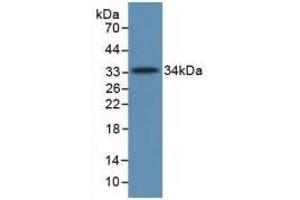 Detection of Recombinant C5a, Human using Monoclonal Antibody to Complement Component 5a (C5a) (C5A anticorps  (AA 678-751))