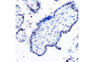 Immunohistochemistry of paraffin-embedded human placenta using STB Rabbit pAb (ABIN6133917, ABIN6148579, ABIN6148580 and ABIN6215957) at dilution of 1:100 (40x lens).