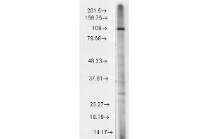 Western Blot analysis of Rat brain membrane lysate showing detection of TrpC7 protein using Mouse Anti-TrpC7 Monoclonal Antibody, Clone S64A-36 .