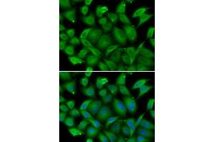 Immunofluorescence analysis of HeLa cell using DEFA1 antibody. (alpha Defensin 1 anticorps)