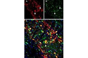 Multiplex staining of GIRK2 (Kir3. (Potassium Inwardly-Rectifying Channel, Subfamily J, Member 6 (KCNJ6) Peptide)