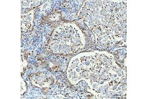 IHC analysis of Aquaporin 4 using anti-Aquaporin 4 antibody (ABIN3043789). (Aquaporin 4 anticorps  (C-Term))