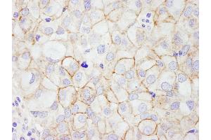 Immunohistochemistry (IHC) image for anti-Receptor tyrosine-protein kinase erbB-2 (ErbB2/Her2) (AA 975-1025) antibody (ABIN7453852)