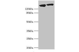 Western blot All lanes: DCTN1 antibody at 20 μg/mL Lane 1: Mouse brain tissue Lane 2: Jurkat whole cell lysate Secondary Goat polyclonal to rabbit IgG at 1/10000 dilution Predicted band size: 142, 128, 137, 139, 127, 141 kDa Observed band size: 142 kDa (Dynactin 1 anticorps  (AA 1084-1278))