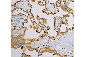 IHC analysis of SLC2A1 using anti-SLC2A1 antibody (ABIN6719416).