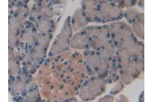 IHC-P analysis of Rat Pancreas Tissue, with DAB staining. (SLIT1 anticorps  (AA 3-112))