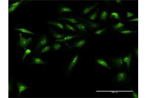 Immunofluorescence of purified MaxPab antibody to DUSP12 on HeLa cell. (DUSP12 anticorps  (AA 1-340))