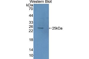 Figure. (HMGB2 anticorps  (AA 2-187))