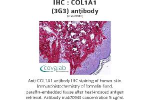 Image no. 1 for anti-Collagen, Type I, alpha 1 (COL1A1) (AA 1021-1108) antibody (ABIN1723789) (COL1A1 anticorps  (AA 1021-1108))