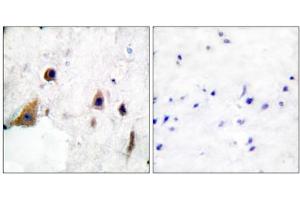 Immunohistochemical analysis of paraffin-embedded human brain tissue, using DARPP-32 (phospho-Thr75) antibody. (DARPP32 anticorps  (pThr75))