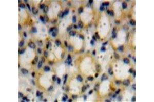 Used in DAB staining on fromalin fixed paraffin-embedded Kidney tissue