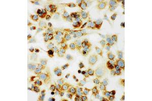Anti-MTCO1 antibody, ICC: HEPA Cell (COX1 anticorps  (C-Term))