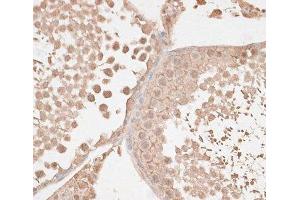Immunohistochemistry of paraffin-embedded Rat testis using VEGF Receptor 2 Polyclonal Antibody at dilution of 1:100 (40x lens). (VEGFR2/CD309 anticorps)