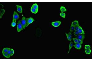 Immunofluorescent analysis of PC-3 cells cells using ABIN7175887 at dilution of 1:100 and Alexa Fluor 488-congugated AffiniPure Goat Anti-Rabbit IgG(H+L)
