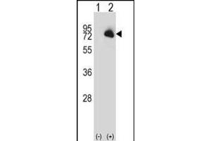 Western blot analysis of BTK (arrow) using rabbit polyclonal BTK Antibody (N-term) (ABIN657469 and ABIN2846497).