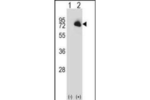 Western blot analysis of BTK (arrow) using rabbit polyclonal BTK Antibody (N-term) (ABIN657469 and ABIN2846497). (BTK anticorps  (N-Term))