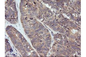 anti-Tripartite Motif Containing 38 (TRIM38) (AA 1-265) antibody