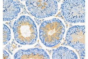 ABIN6266014 and ABIN6273185 at 1/100 staining Mouse testis tissue by IHC-P.