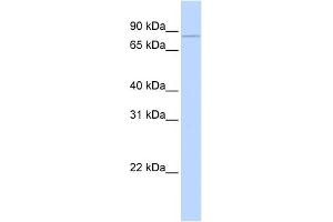 WB Suggested Anti-CPEB3 Antibody Titration: 0. (CPEB3 anticorps  (Middle Region))
