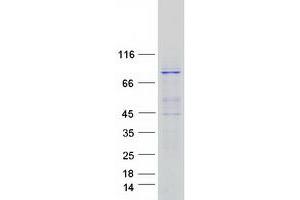 Validation with Western Blot