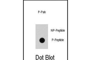 Dot blot analysis of anti-Cdc25A Phospho-specific Pab (ABIN389906 and ABIN2839740) on nitrocellulose membrane. (CDC25A anticorps  (pSer79))
