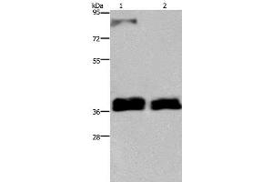 Western Blot analysis of 231 and A172 cell using FETUB Polyclonal Antibody at dilution of 1:700 (FETUB anticorps)