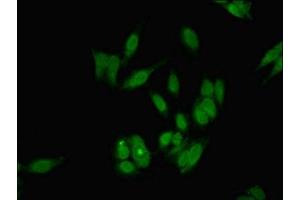 Immunofluorescent analysis of Hela cells using ABIN7154810 at dilution of 1:100 and Alexa Fluor 488-congugated AffiniPure Goat Anti-Rabbit IgG(H+L) (DKC1 anticorps  (AA 94-170))