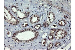 Image no. 2 for anti-Docking Protein 7 (DOK7) antibody (ABIN1497883)