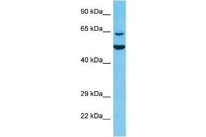 Host:  Rabbit  Target Name:  KLHL6  Sample Type:  293T Whole Cell lysates  Antibody Dilution:  1ug/ml