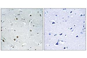 Immunohistochemistry analysis of paraffin-embedded human brain tissue using DDX24 antibody.