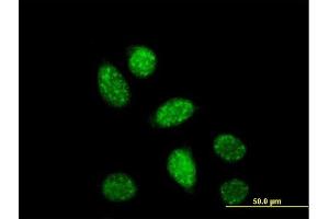 Immunofluorescence of monoclonal antibody to CREB1 on HeLa cell.