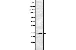Western blot analysis of EF-1β using HT29 whole cell lysates (EEF1B2 anticorps  (Internal Region))