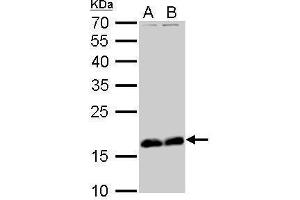 WB Image Stathmin 1 antibody detects STMN1 protein by Western blot analysis. (Stathmin 1 anticorps  (C-Term))