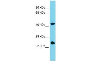Host: Rabbit Target Name: Stra8 Sample Type: Mouse Liver lysates Antibody Dilution: 1. (STRA8 anticorps  (C-Term))
